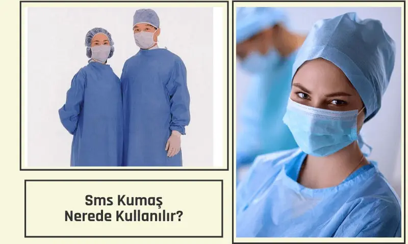sms-kumas-ozellikleri
